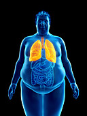 Illustration of an obese man's lungs