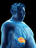 Illustration of an obese man's spleen