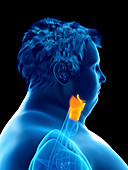 Illustration of an obese man's larynx