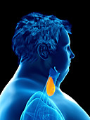 Illustration of an obese man's thyroid gland