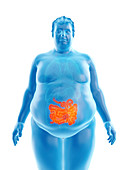 Illustration of an obese man's intestine