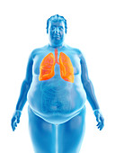 Illustration of an obese man's lungs