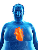 Illustration of an obese man's heart