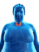 Illustration of an obese man's thyroid gland