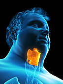 Illustration of an obese man's larynx