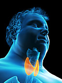 Illustration of an obese man's thyroid gland