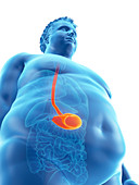 Illustration of an obese man's stomach