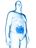 Illustration of an obese man's small intestines