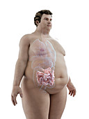 Illustration of an obese man's intestine