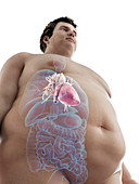 Illustration of an obese man's heart