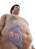 Illustration of an obese man's kidneys