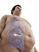 Illustration of an obese man's pancreas