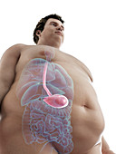 Illustration of an obese man's stomach