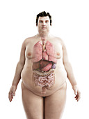 Illustration of an obese man's organs