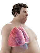 Illustration of an obese man's lungs