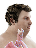 Illustration of an obese man's throat anatomy
