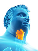 Illustration of an obese man's larynx