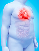 Illustration of an obese man's heart