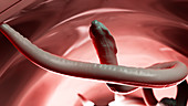 Illustration of a roundworm in a human colon