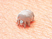 Illustration of a scabies mite