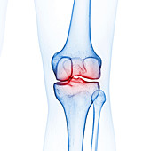 Illustration of the knee bones