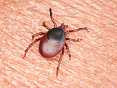 Illustration of a tick crawling on human skin