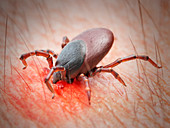 Illustration of a tick biting human skin