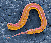 C elegans, SEM