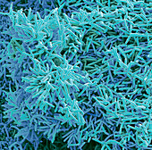 Plaque-forming bacteria, SEM