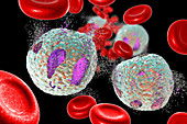 Acute lymphoblastic leukaemia treatment, illustration