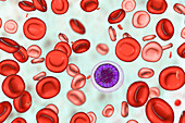 Blood after hemotransfusion for anaemia, illustration