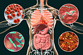 Bacteria that cause human infections, illustration