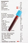 Blood test results with blood sample