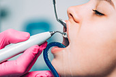 Orthodontist cleaning girl's braces