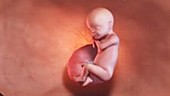 30 week old fetus