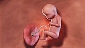 29 week old fetus