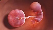 11 week old fetus