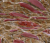 Striated muscle tissue, SEM