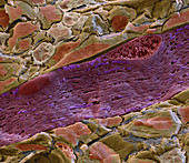 Normal muscle tissue, SEM
