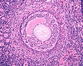 Ovarian early tertiary follicle,light micrograph