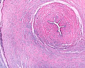 Umbilical cord,light micrograph