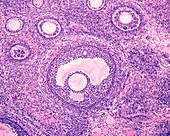 Ovarian secondary and tertiary follicles,light micrograph