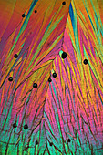 Dopamine crystals,light micrograph