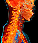 Human cervical spine anatomy,3D CT scan