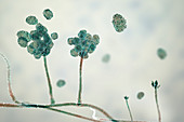 Stachybotrys toxic mould,illustration