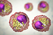 Macrophage foam cell,illustration