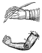 Artificial limbs, 1510-1590