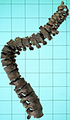 Spinal column showing the curvature of the spine