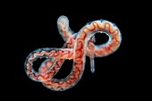 Tubifex worm, light micrograph