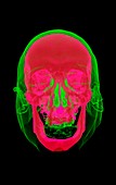 Head and skull, 3D CT scan